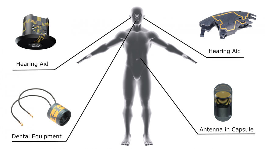 3D-MID – minimized sensing high-tech within the patient 